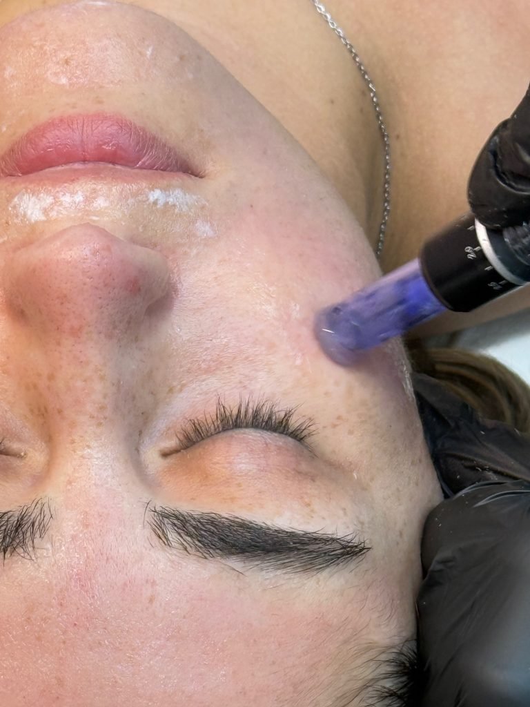 Collagen Rejuvenation Therapy